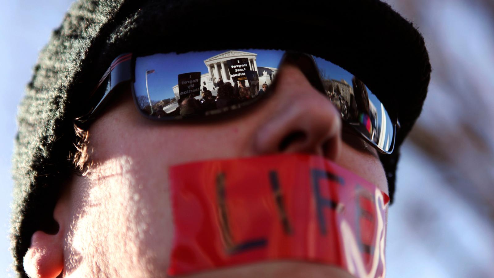 Aborto financiero: la polémica por el “derecho a decidir” de los hombres